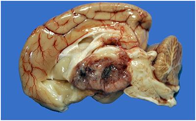 Clinicopathologic Features, Diagnosis, and Characterization of the Immune Cell Population in Canine Choroid Plexus Tumors